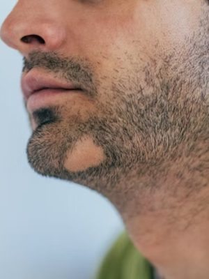 imgi_37_istockphoto-1156708706-170667a